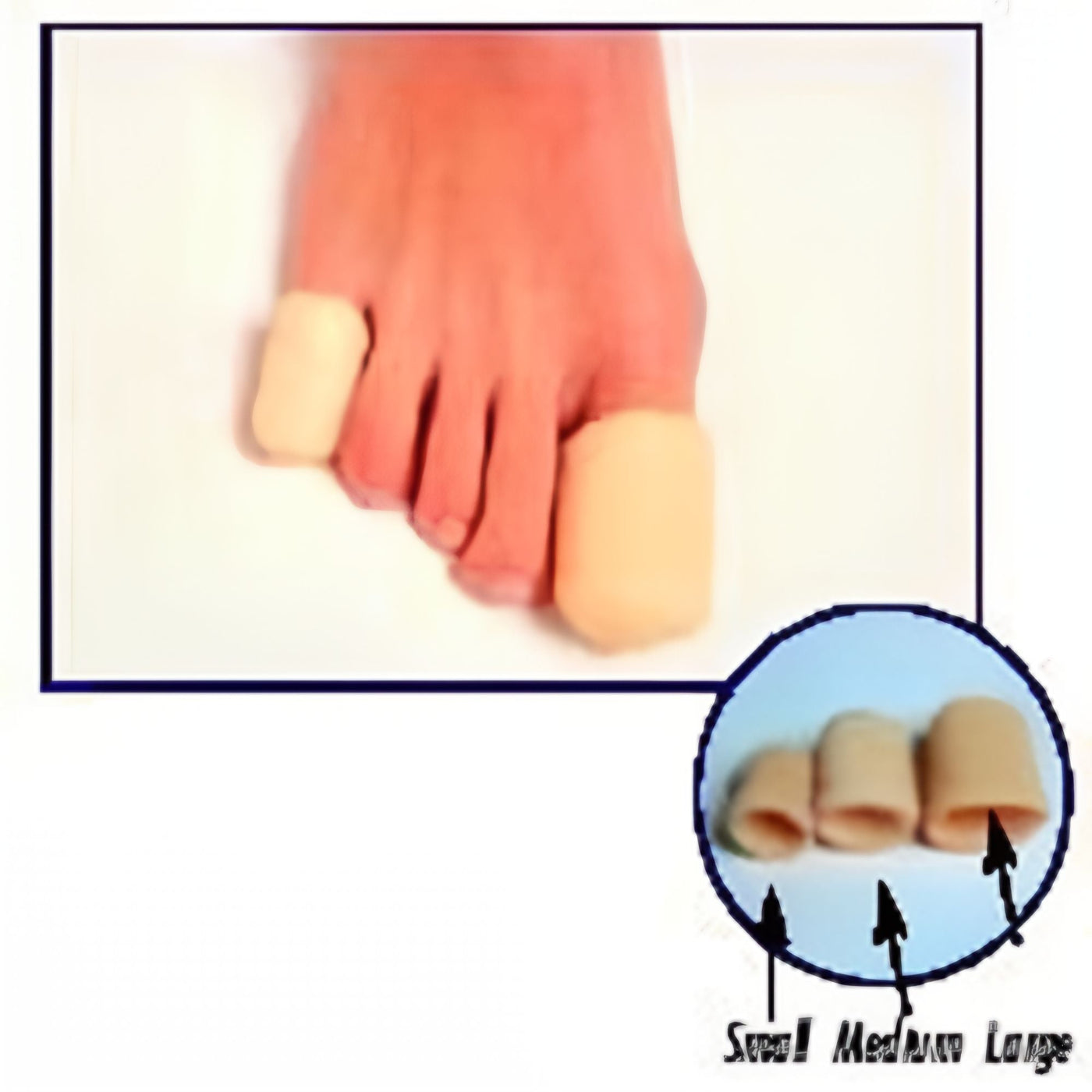 Toe Caps - Pack of 3
