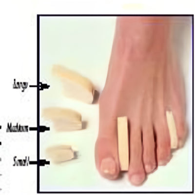 Toe Separator - Box of 12