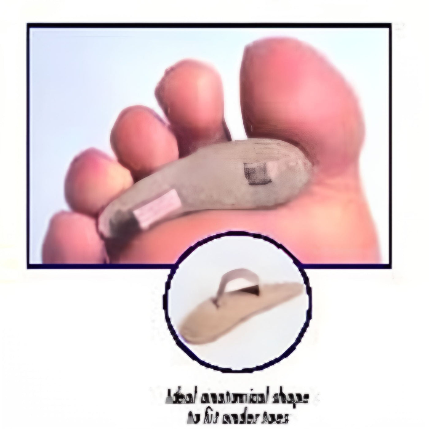 Toe Crest - Pack of 3