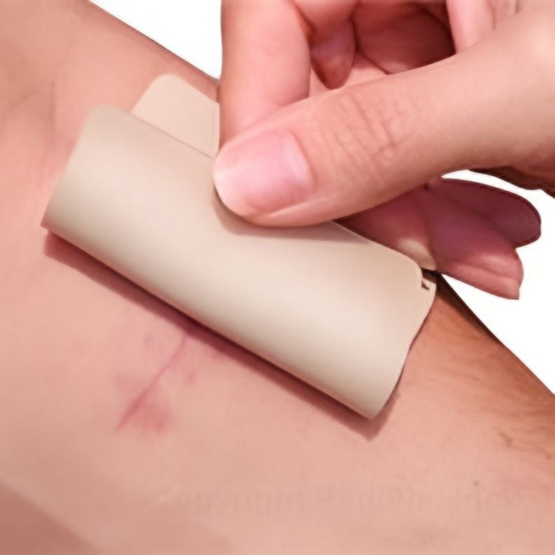 Visco-GEL Silicone Scar Sheet – 4"x6" (Clear Top Cover, Each)